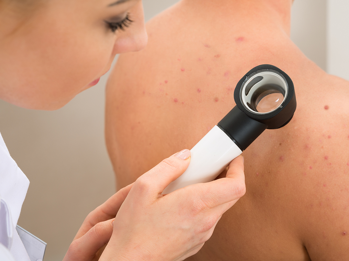 Dermatologist examining a man's back