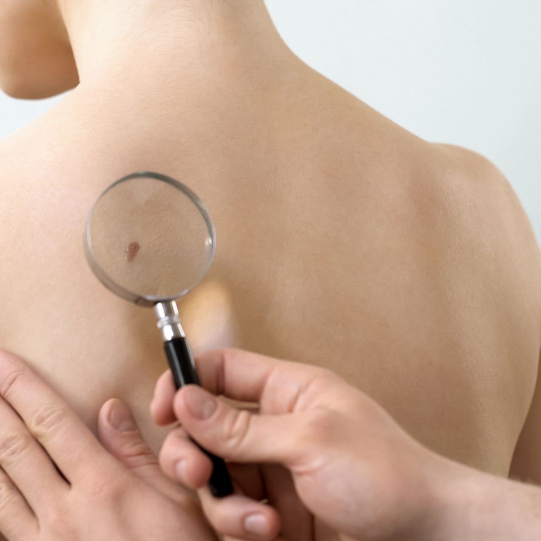 skin care specialist inspecting skin