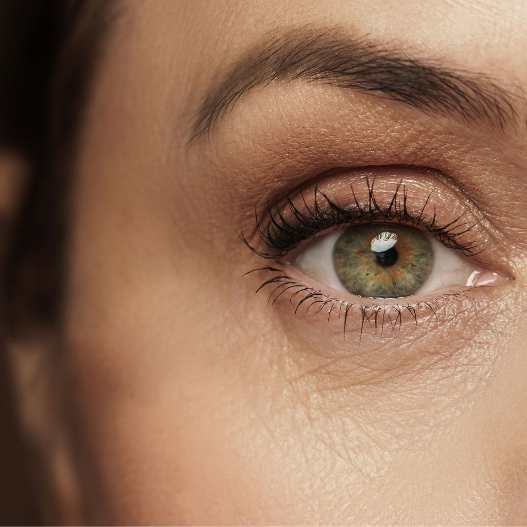 aging woman wrinkles around eye