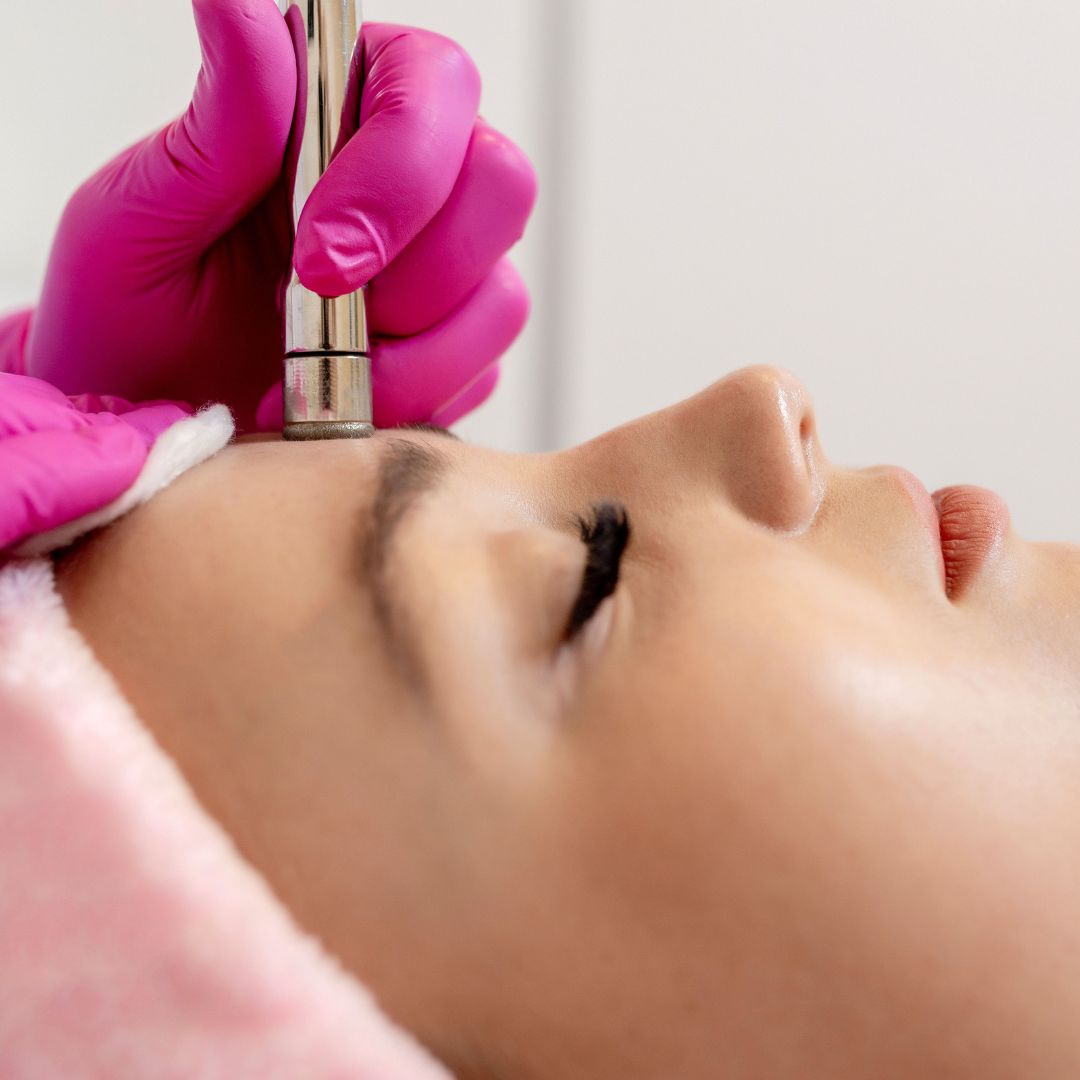 microdermabrasion