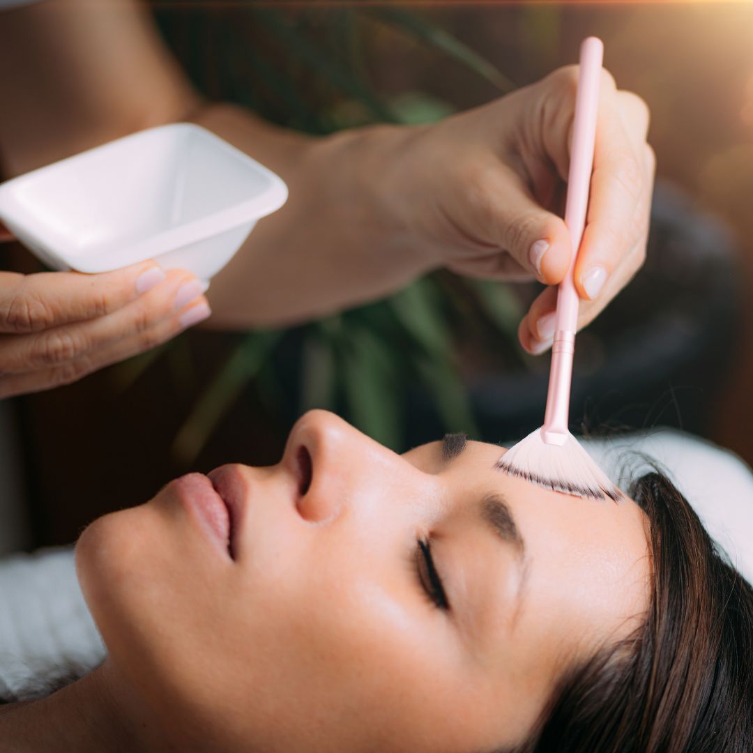 chemical face peel