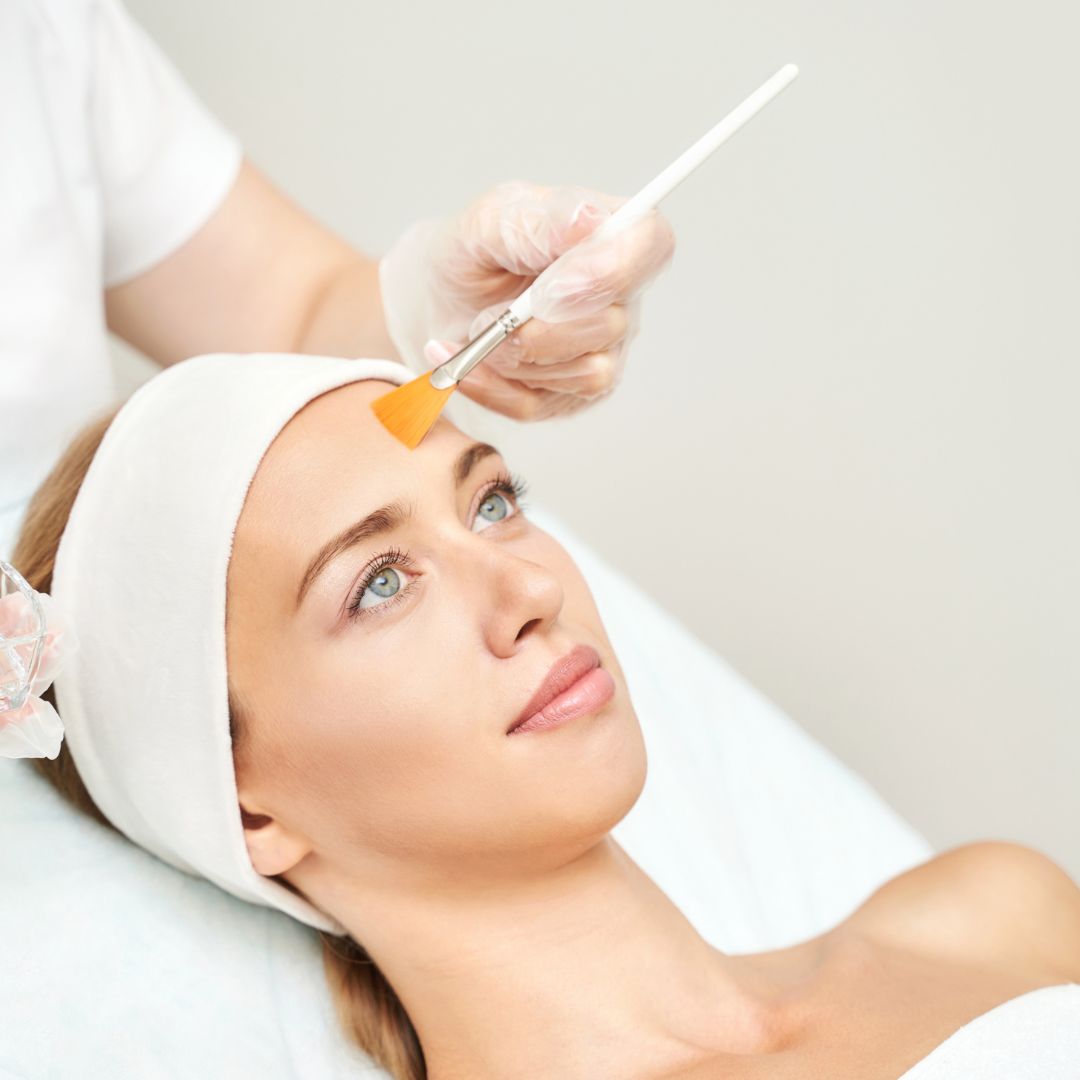 face peel