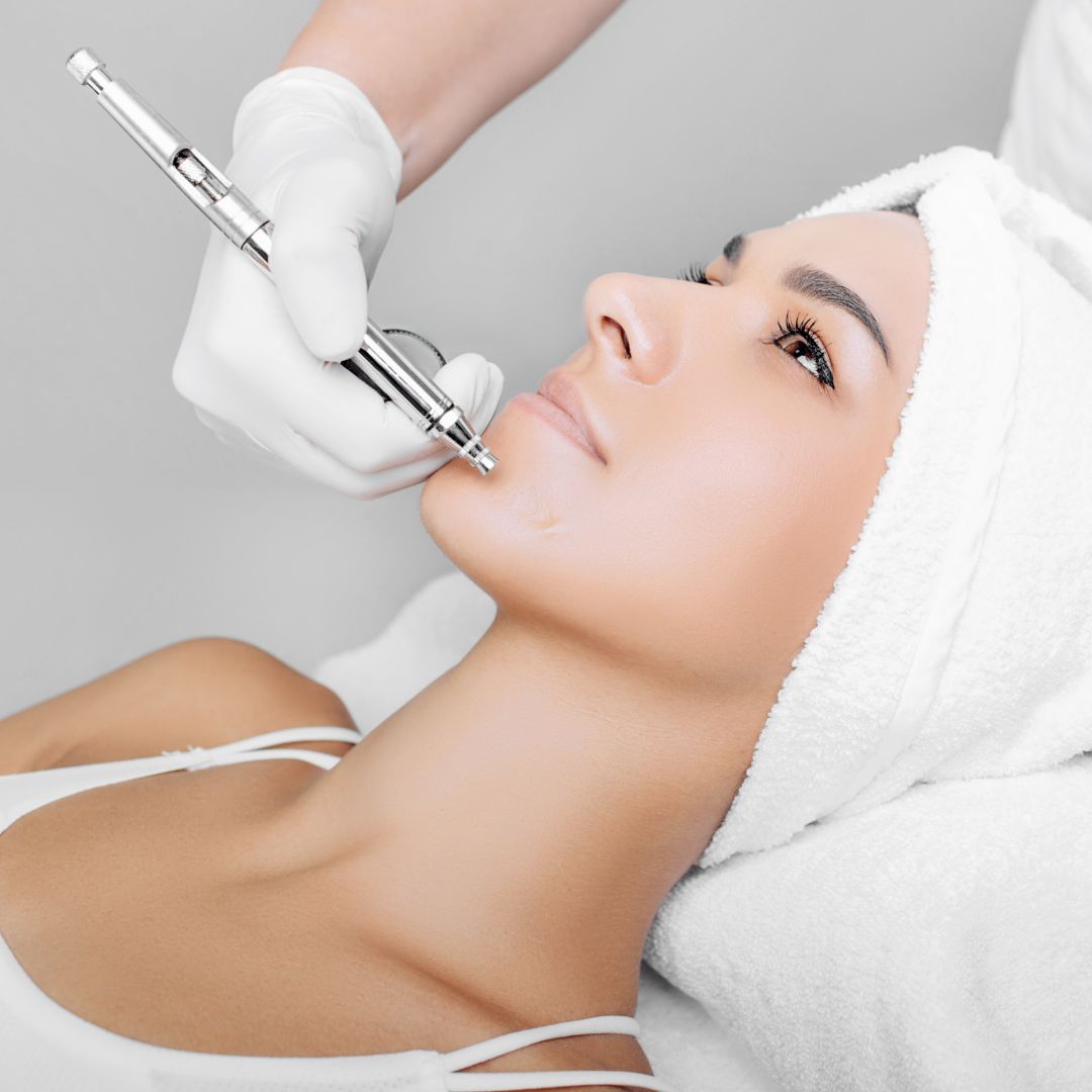 jet face peel