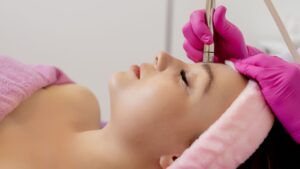 microdermabrasion procedure