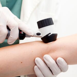 scanning arm