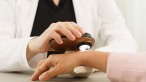 dermatologist looking at hand