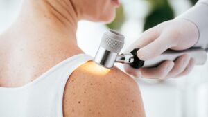 dermatologist looking at freckled shoulder