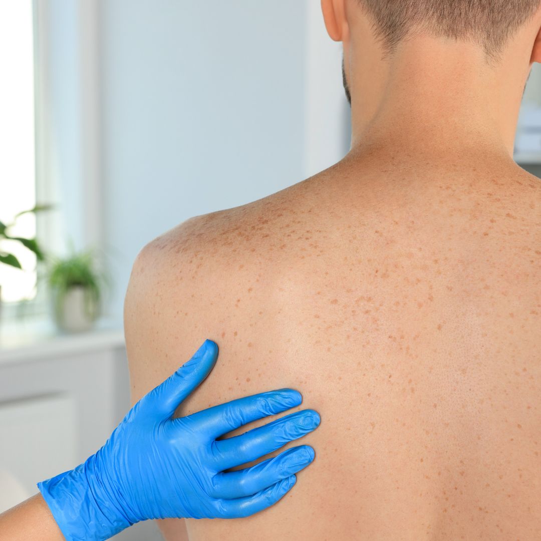 Examining a patient's skin