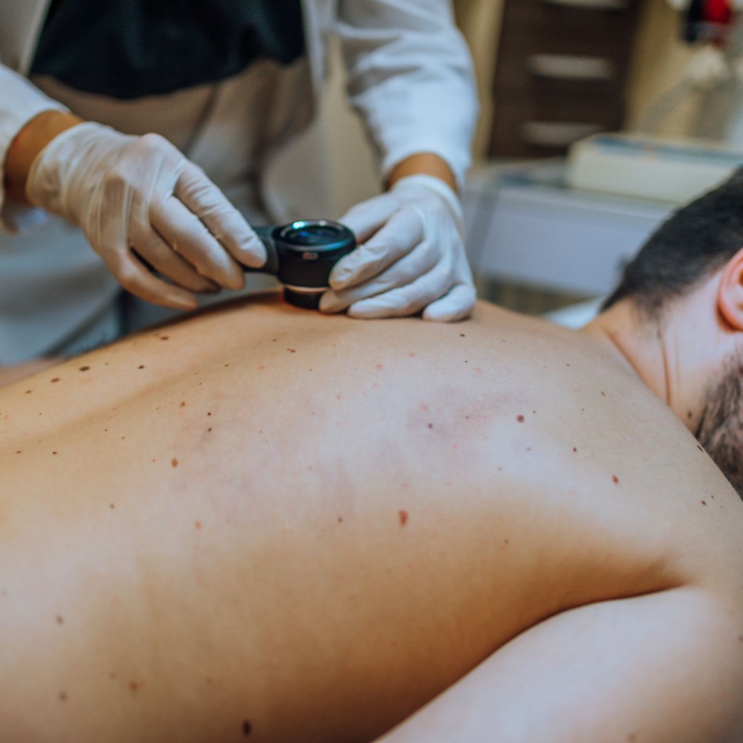 Dermatoscopy on male patient