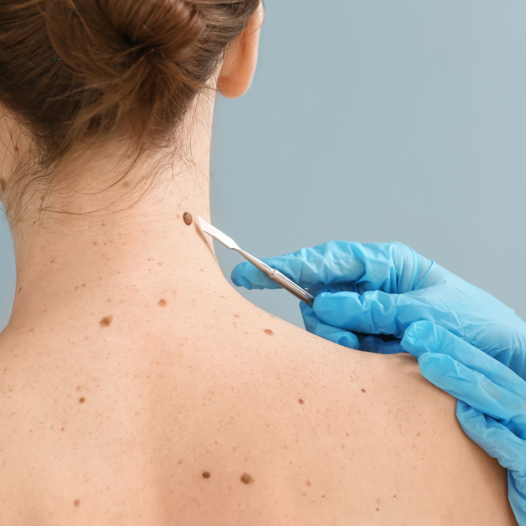 doctor looking at skin