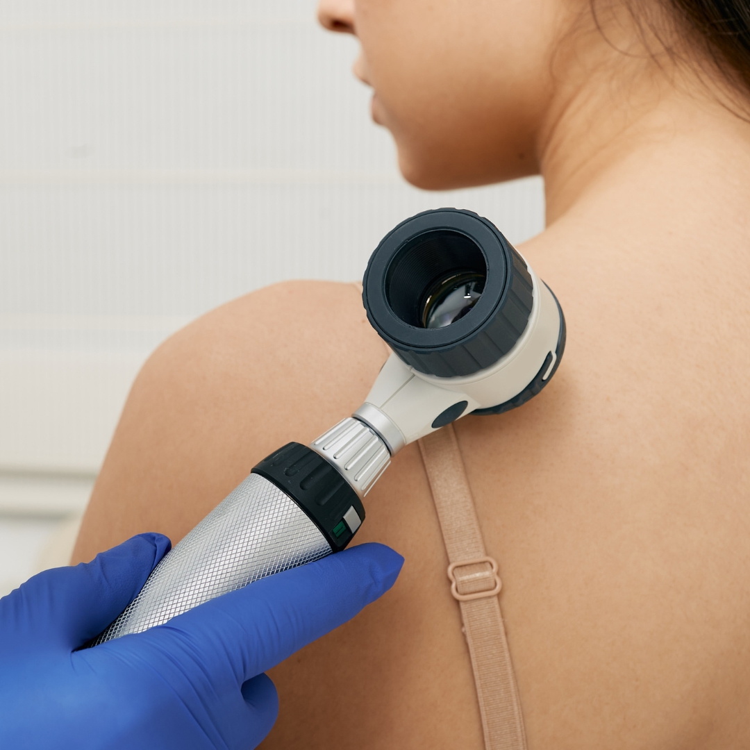 image of a skin exam
