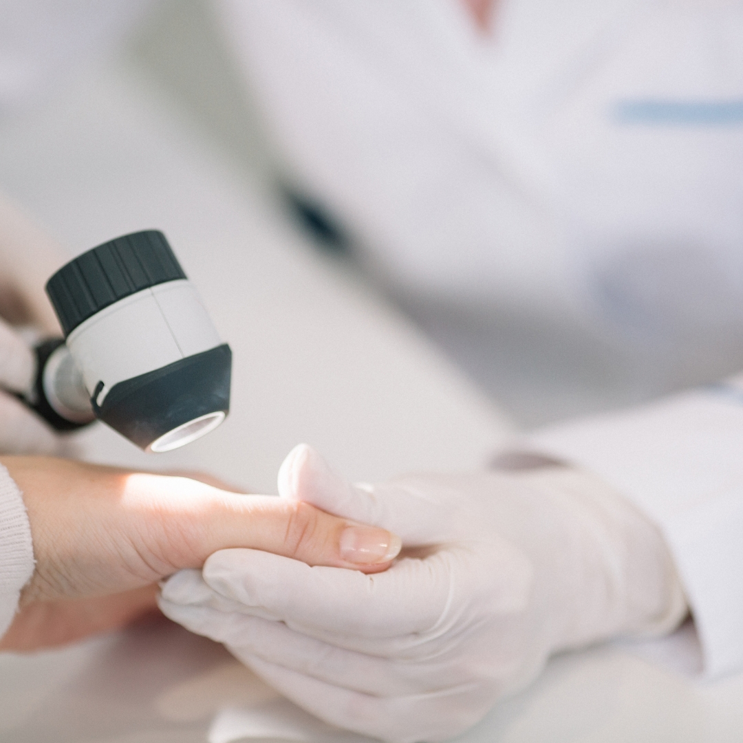 image of a skin exam