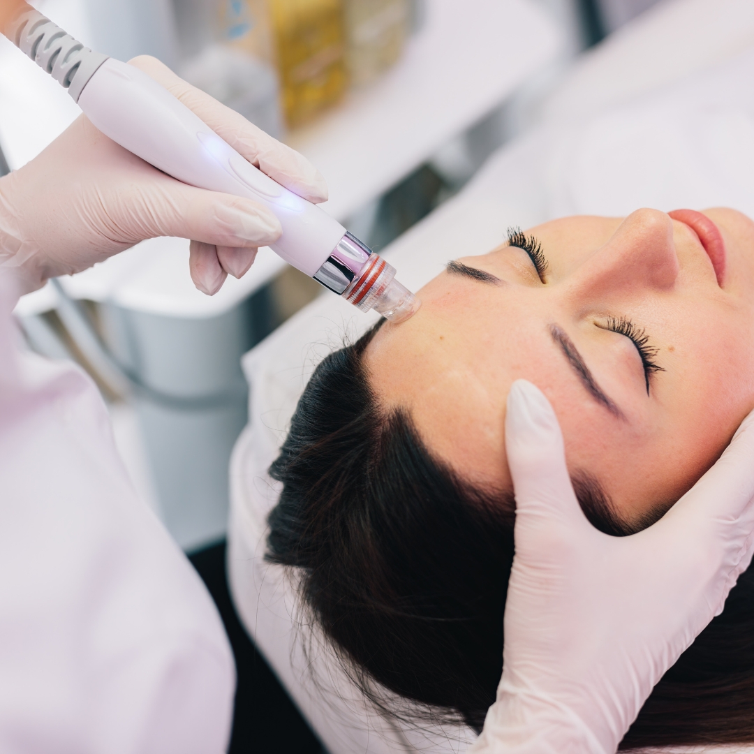 image of a facial procedure 