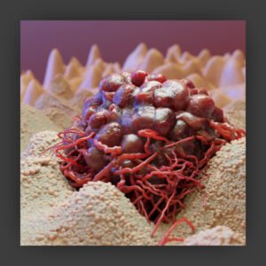 Microscopic look at cancer growing