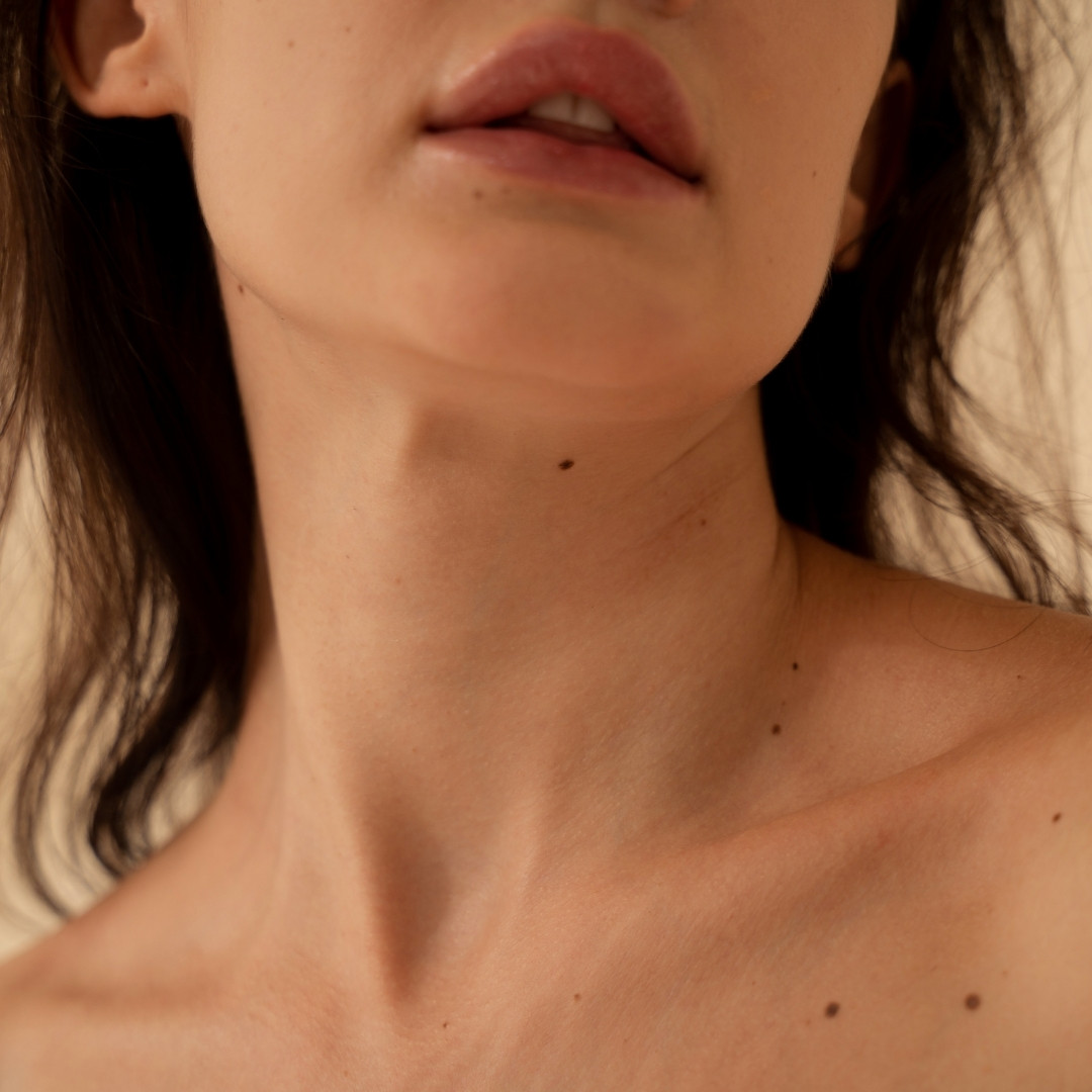 Eczema - Update - Image 2