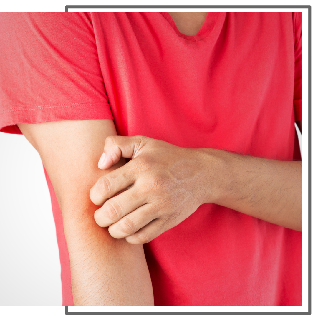 person scratching their arm