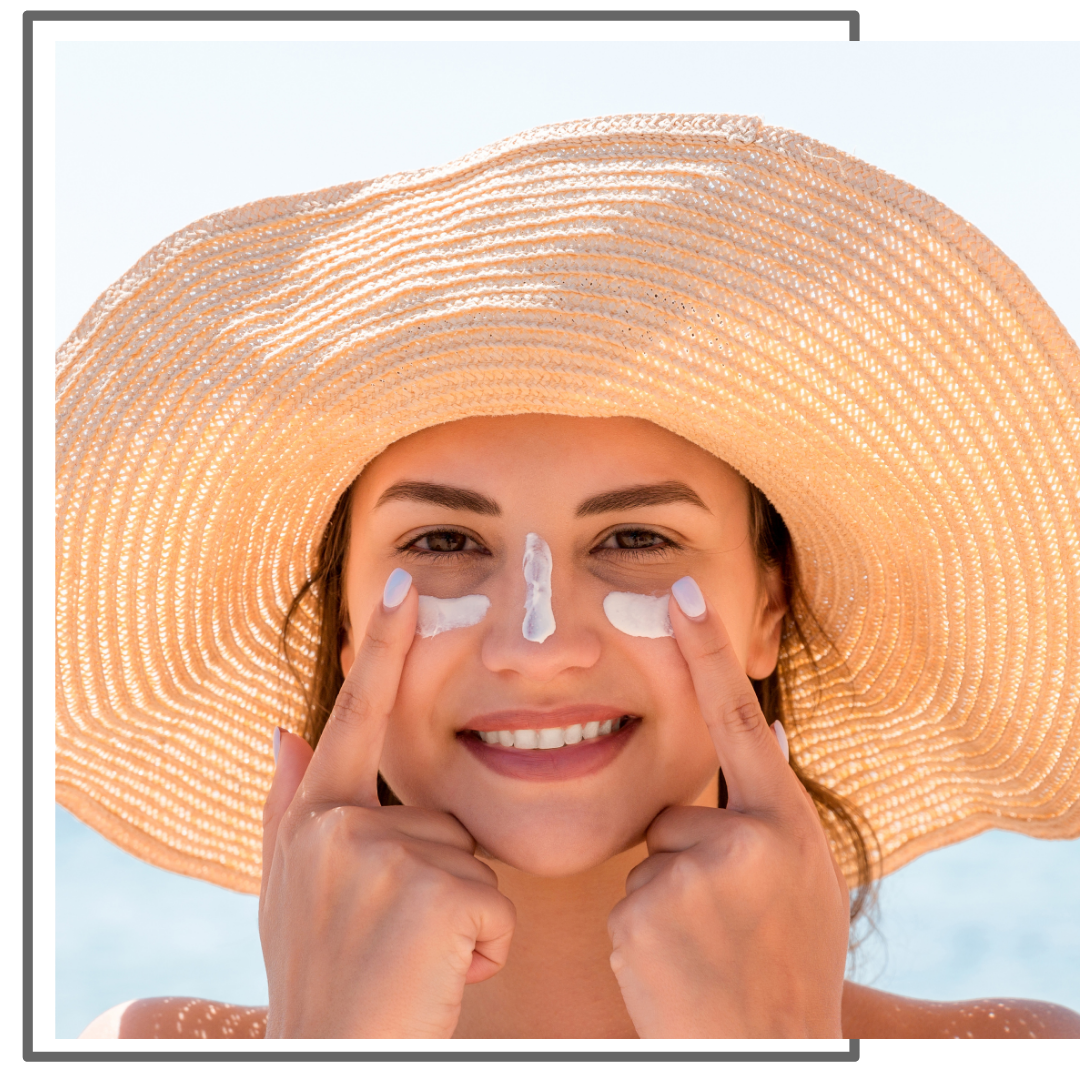 Rosacea 3