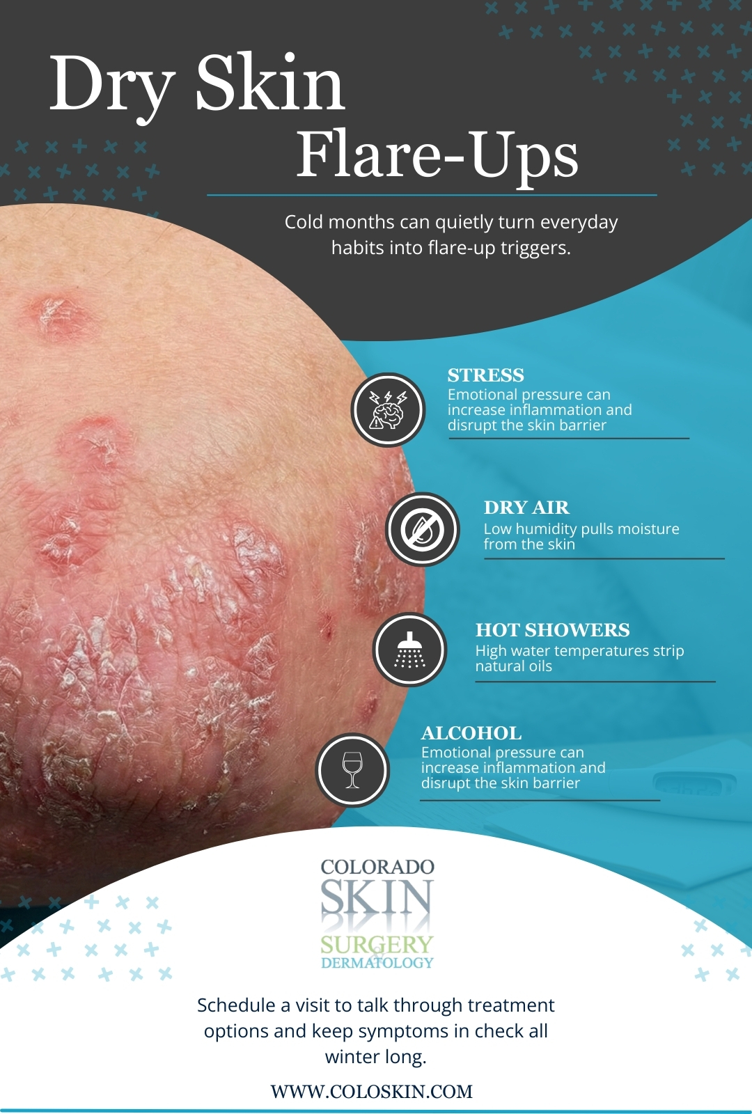Dry Skin Flare Ups infrographic